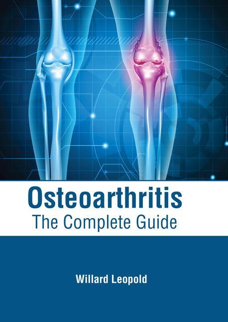 Könyv Osteoarthritis: The Complete Guide 