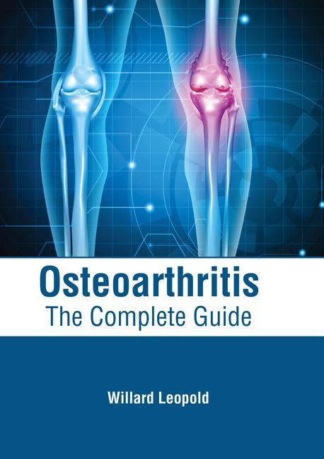 Książka Osteoarthritis: The Complete Guide 