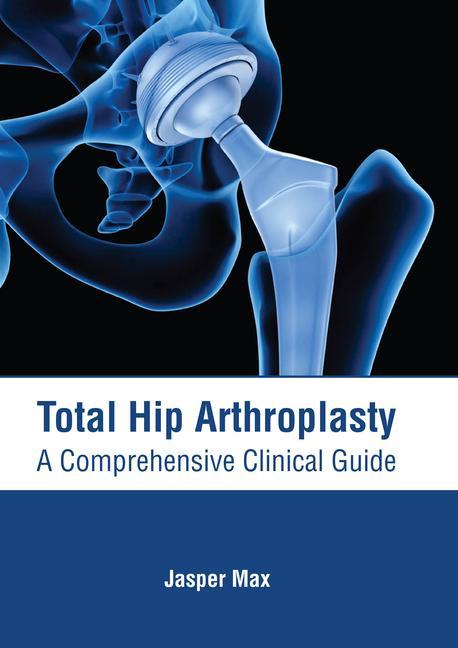 Книга Total Hip Arthroplasty: A Comprehensive Clinical Guide 