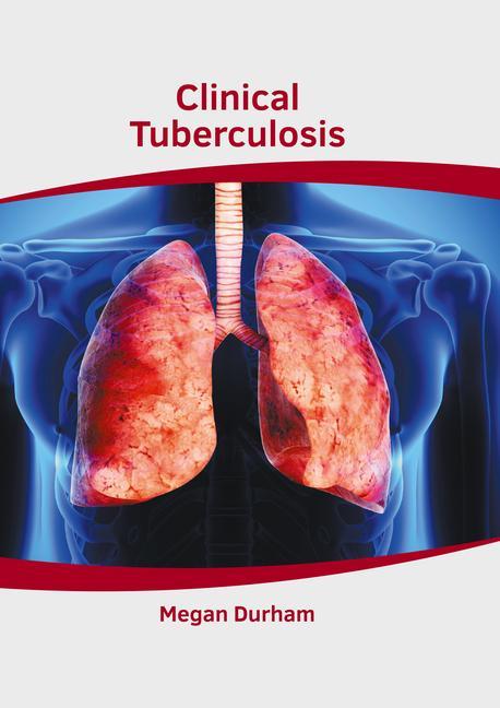Kniha Clinical Tuberculosis 