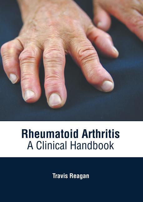 Carte Rheumatoid Arthritis: A Clinical Handbook 