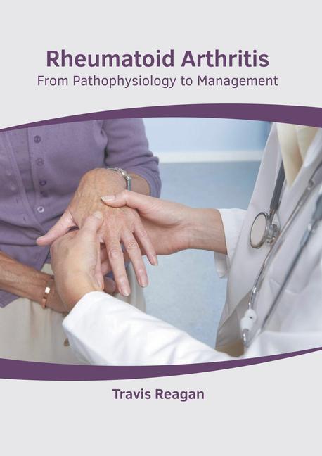 Książka Rheumatoid Arthritis: From Pathophysiology to Management 