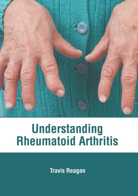 Carte Understanding Rheumatoid Arthritis 