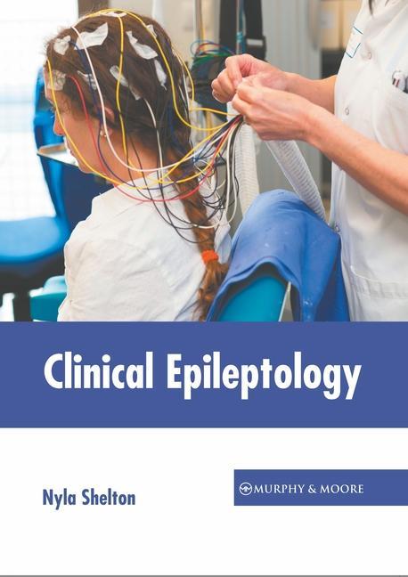 Kniha Clinical Epileptology 