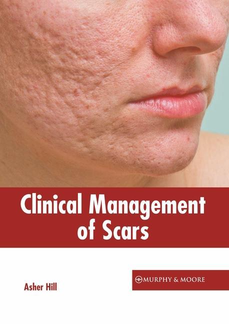 Kniha Clinical Management of Scars 