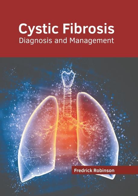Könyv Cystic Fibrosis: Diagnosis and Management 