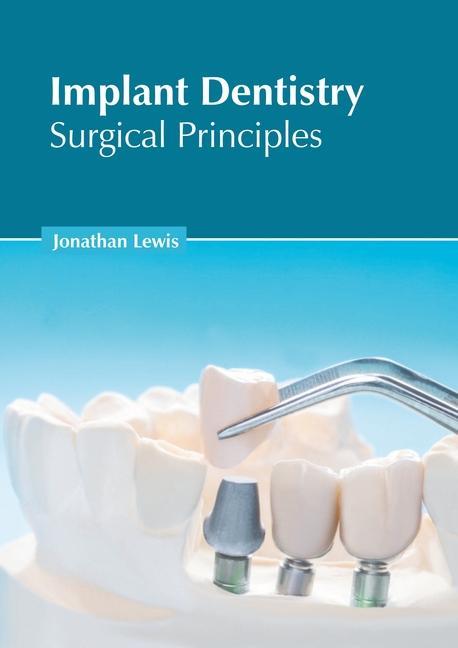Kniha Implant Dentistry: Surgical Principles 