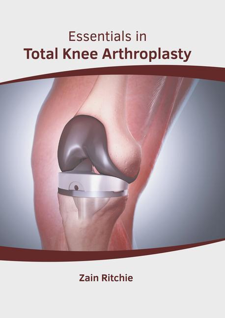Könyv Essentials in Total Knee Arthroplasty 