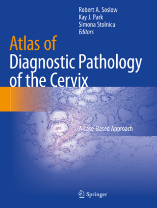 Książka Atlas of Diagnostic Pathology of the Cervix Simona Stolnicu