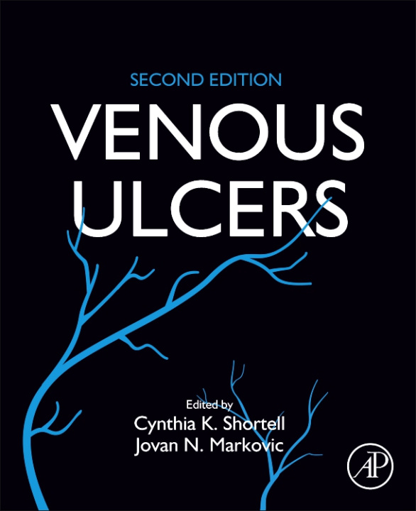 Kniha Venous Ulcers Cynthia Shortell