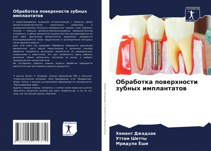 Boek Obrabotka powerhnosti zubnyh implantatow Uttam Shetty