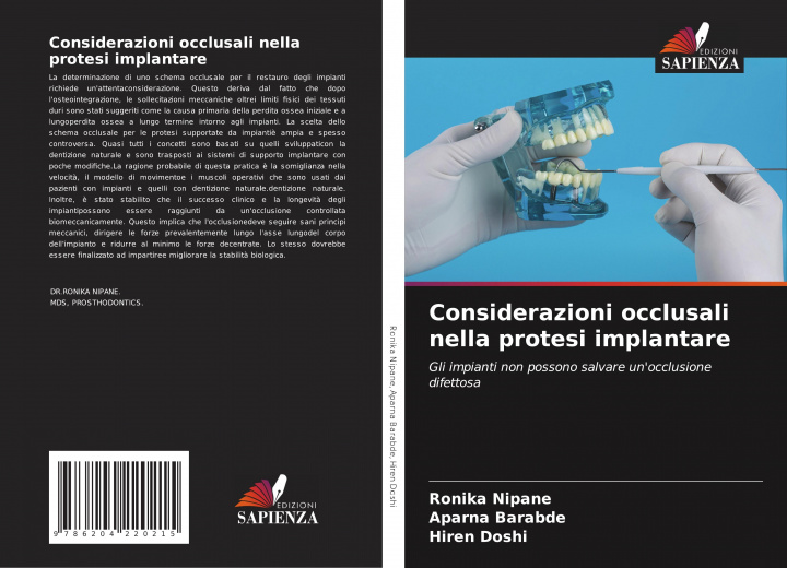 Kniha Considerazioni occlusali nella protesi implantare Aparna Barabde