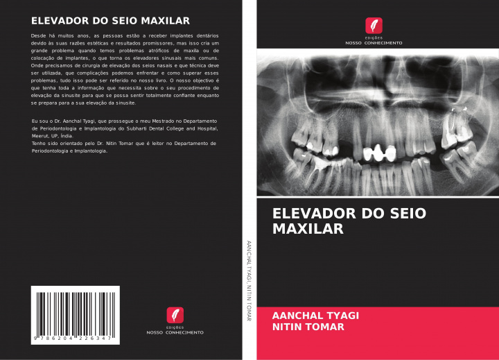 Kniha ELEVADOR DO SEIO MAXILAR Nitin Tomar