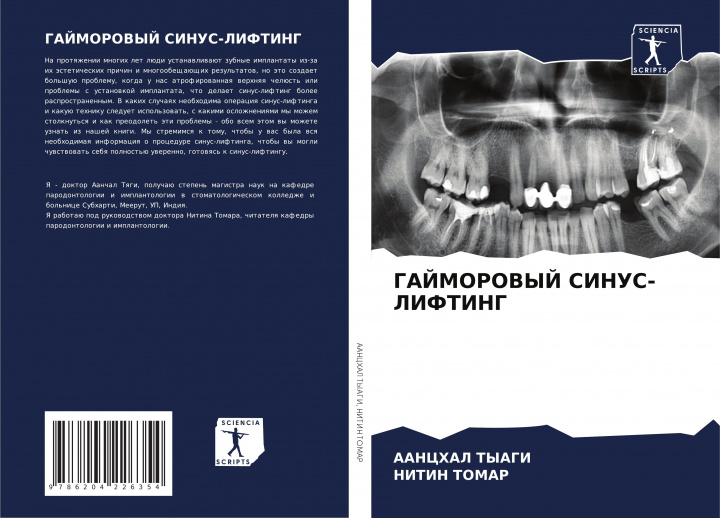 Knjiga GAJMOROVYJ SINUS-LIFTING Nitin Tomar