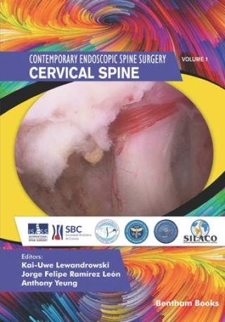 Kniha Cervical Spine Anthony Yeung