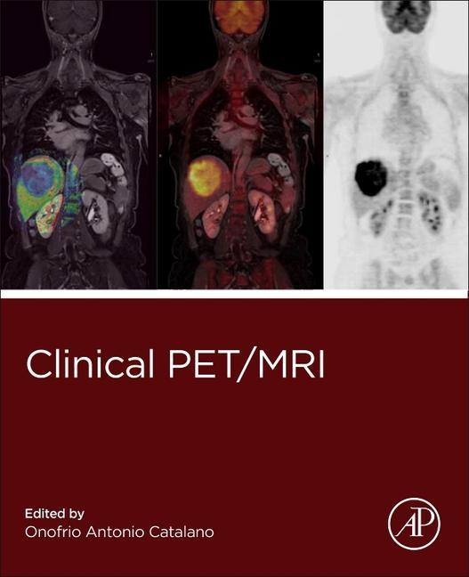 Книга Clinical PET/MRI Onofrio Catalano