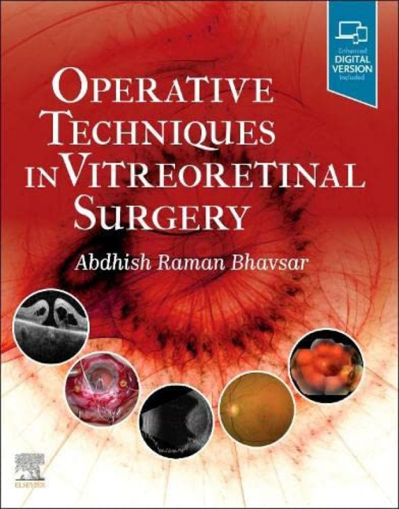 Book Operative Techniques in Vitreoretinal Surgery Abdhish Bhavsar