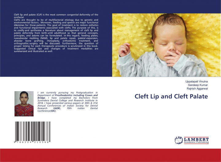 Kniha Cleft Lip and Cleft Palate Sandeep Kumar