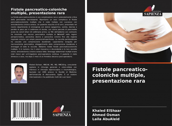 Kniha Fistole pancreatico-coloniche multiple, presentazione rara Ahmed Osman