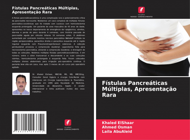 Kniha Fístulas Pancreáticas Múltiplas, Apresentaç?o Rara Ahmed Osman