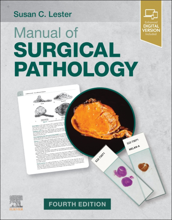 Knjiga Manual of Surgical Pathology Susan C. Lester
