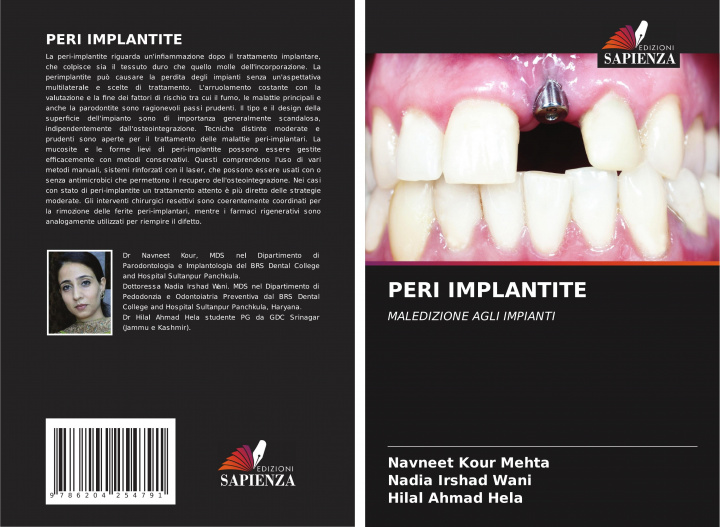 Книга PERI IMPLANTITE Nadia Irshad Wani