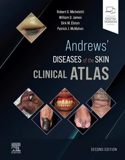 Kniha Andrews' Diseases of the Skin Clinical Atlas WILLIAM D. JAMES