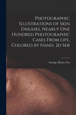 Carte Photographic Illustrations of Skin Diseases, Nearly One Hundred Photographic Cases From Life, Colored by Hand. 2d Ser George Henry 1846-1937 Fox