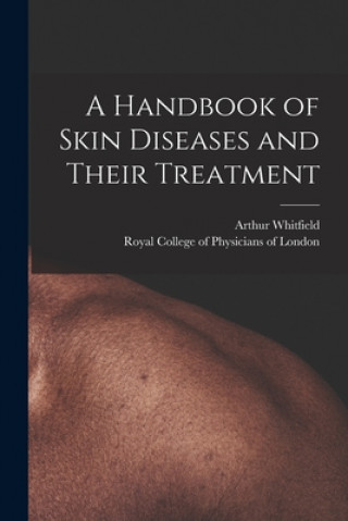 Carte A Handbook of Skin Diseases and Their Treatment Arthur 1868- Whitfield
