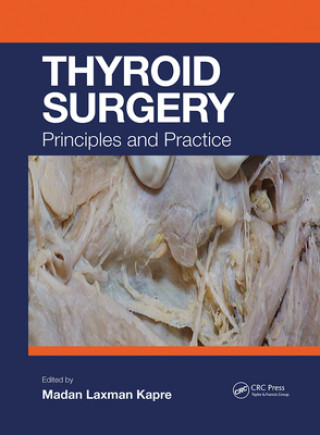 Книга Thyroid Surgery Madan Kapre