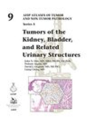 Kniha Tumors of the Kidney, Bladder, and Related Urinary Structures John Eble