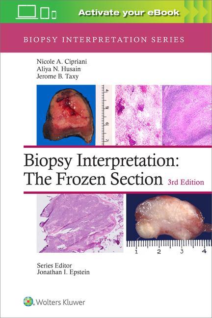 Kniha Biopsy Interpretation: The Frozen Section Nicole A. Cipriani