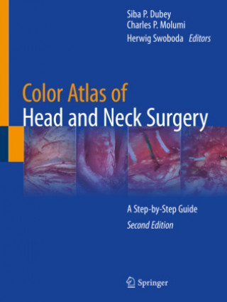 Carte Color Atlas of Head and Neck Surgery: A Step-By-Step Guide Siba P. Dubey