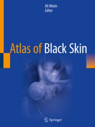 Buch Atlas of Black Skin Ali Moiin