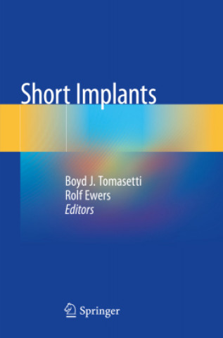 Knjiga Short Implants Boyd J. Tomasetti