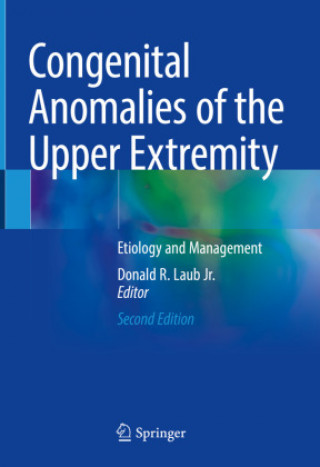 Kniha Congenital Anomalies of the Upper Extremity: Etiology and Management Donald R. Laub Jr