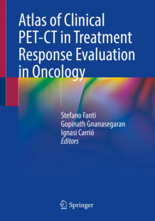 Könyv Atlas of Clinical Pet-CT in Treatment Response Evaluation in Oncology Stefano Fanti
