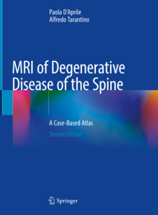Carte MRI of Degenerative Disease of the Spine: A Case-Based Atlas Paola D'Aprile