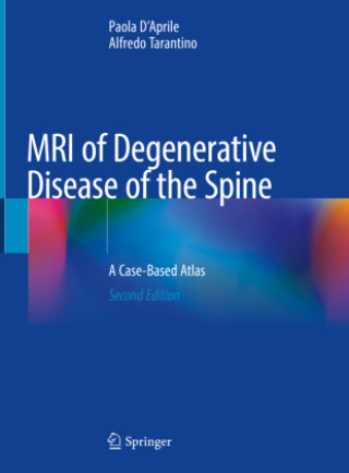 Książka MRI of Degenerative Disease of the Spine: A Case-Based Atlas Paola D'Aprile