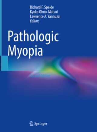 Kniha Pathologic Myopia Richard F. Spaide