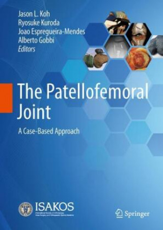 Książka The Patellofemoral Joint: A Case-Based Approach Jason L. Koh