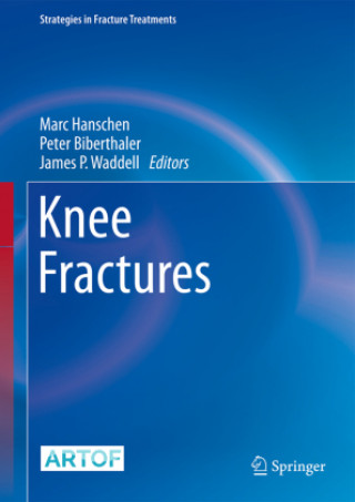 Kniha Knee Fractures Marc Hanschen