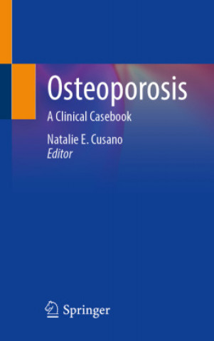Carte Osteoporosis: A Clinical Casebook Natalie E. Cusano