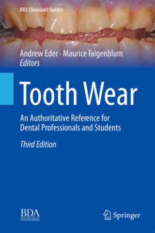 Book Tooth Wear Andrew Eder
