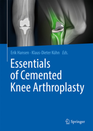 Book Essentials of Cemented Knee Arthroplasty Erik Hansen