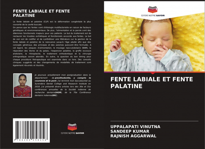 Book FENTE LABIALE ET FENTE PALATINE Sandeep Kumar