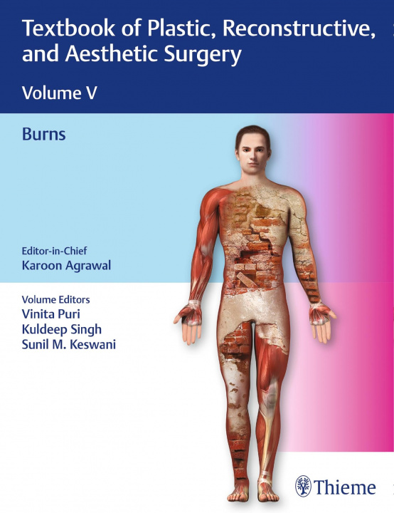 Carte Textbook of Plastic, Reconstructive, and Aesthetic Surgery, Vol 5: Burns 