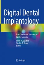 Kniha Digital Dental Implantology: From Treatment Planning to Guided Surgery Jorge M. Galante