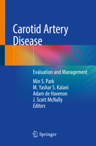 Kniha Carotid Artery Disease J. Scott McNally