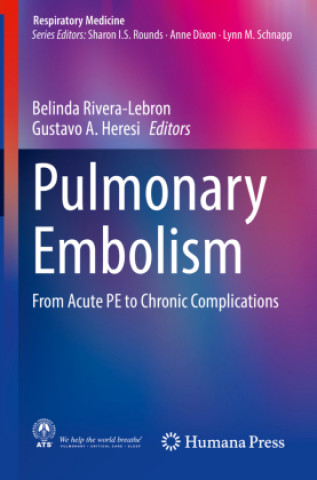 Knjiga Pulmonary Embolism Belinda Rivera-Lebron